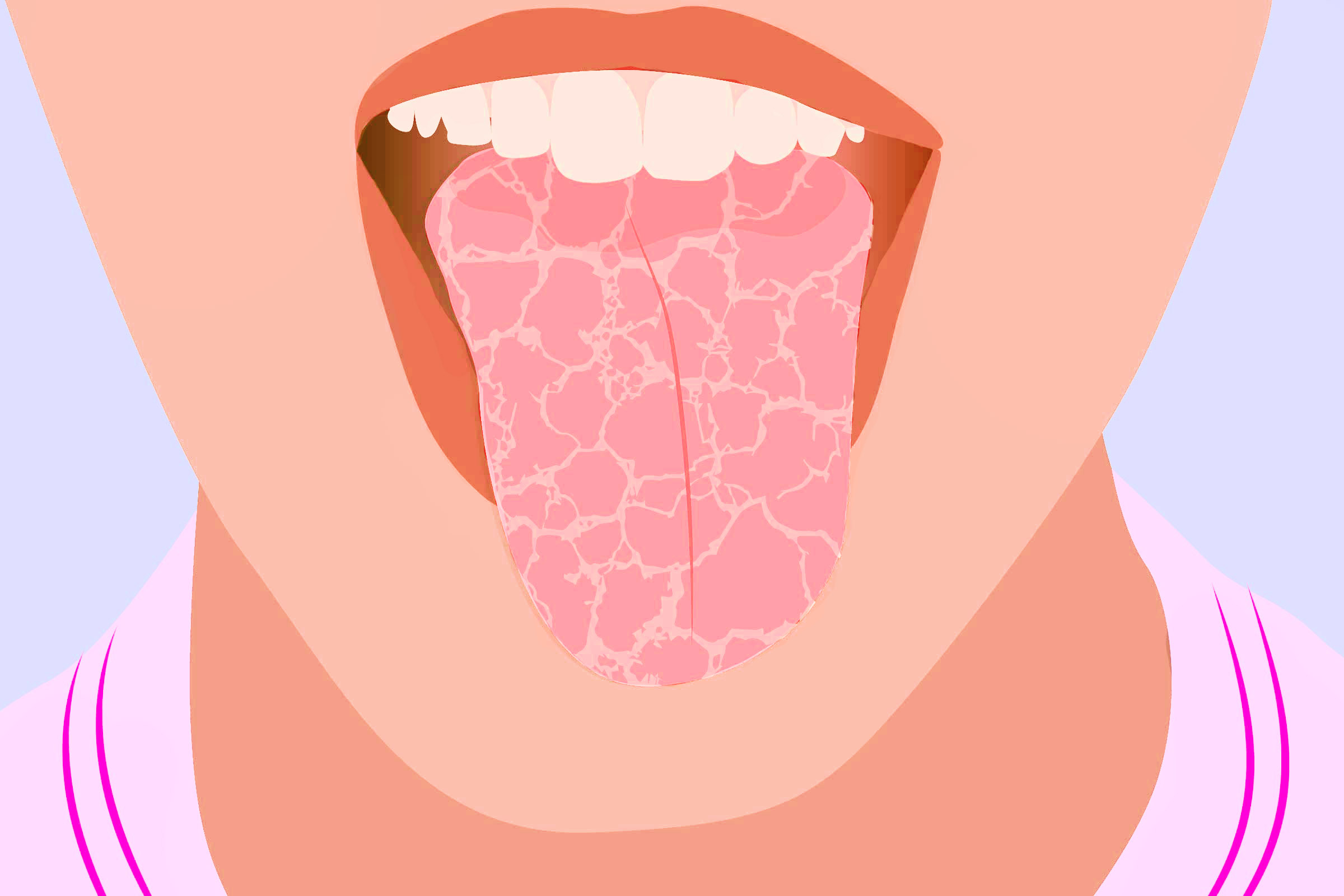 Почему сушит рот: причины и советы